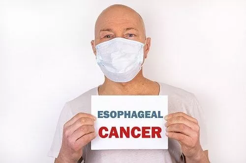 Esophageal-Cancer