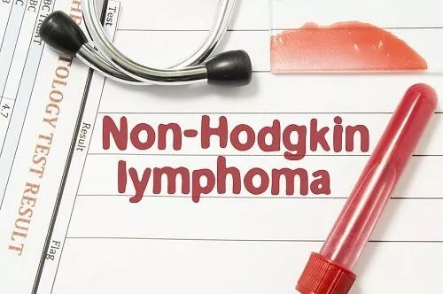 Non-Hodgkin’s-Lymphoma Non-Hodgkin’s-Lymphoma